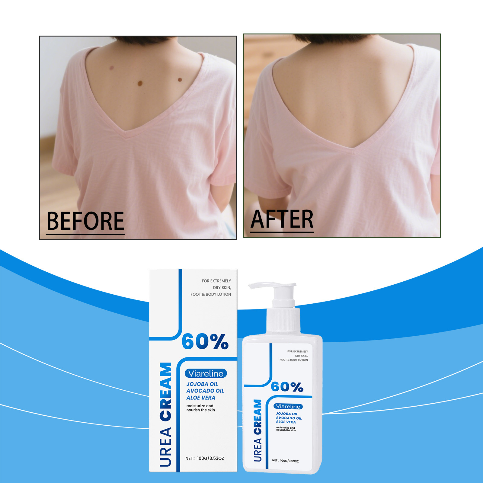 Urea Body Lotion - Image 3